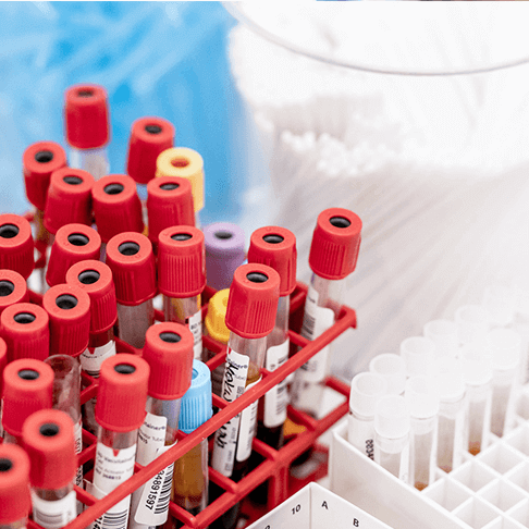 Próbki krwi i inne próbki w stojaku na tle laboratoryjnym